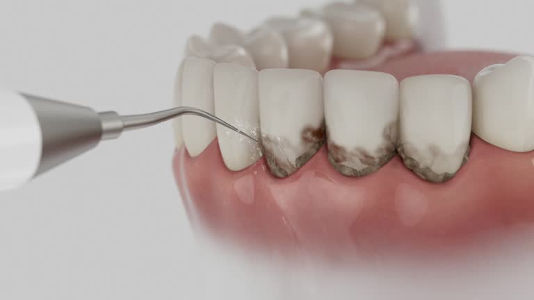 Reliable Dental Implants contractor in Plainwell, MI by Smile Center Dentistry